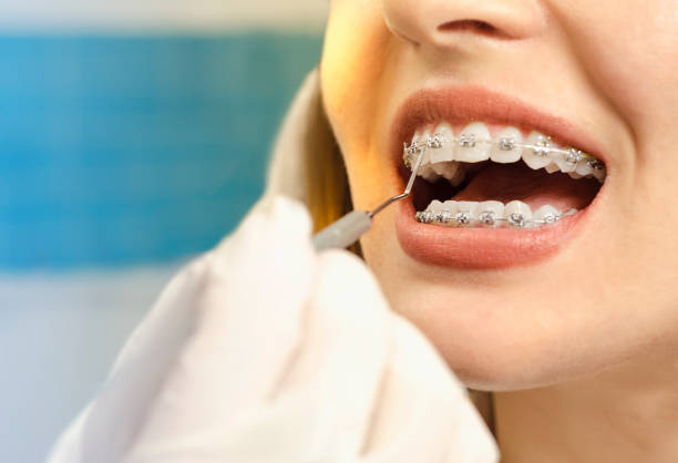 The Latest Information About Orthodontic Treatment